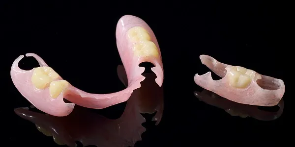 ノンクラスプデンチャー